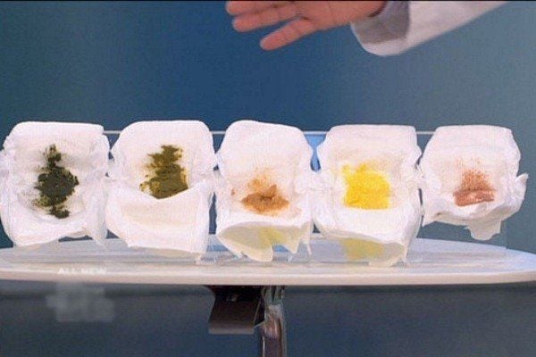 Phân của em bé sơ sinh: màu sắc, kết cấu và những Điều cần lưu Ý